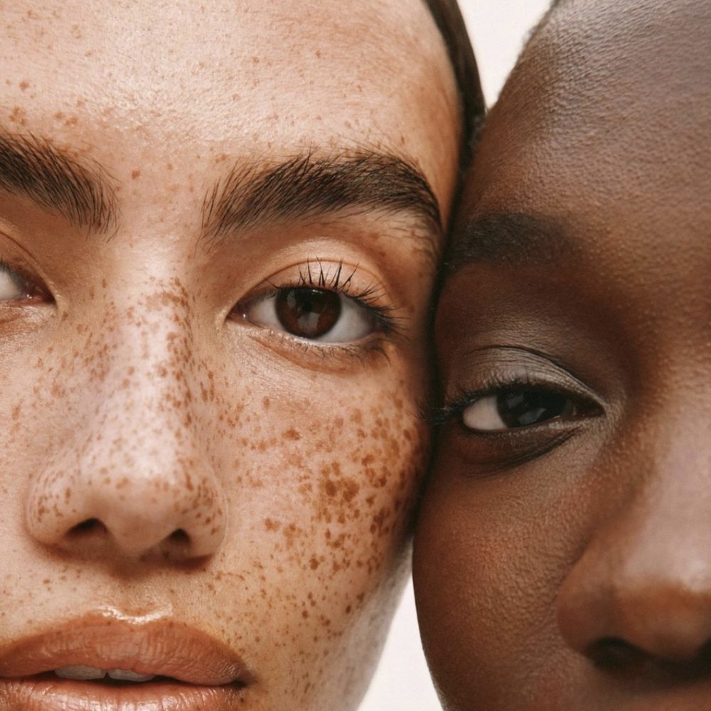 Fine Lines and Wrinkles